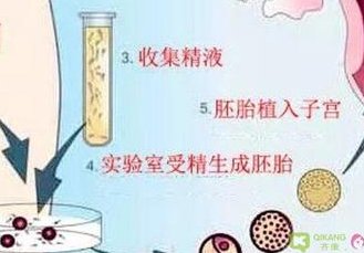 在临沂市做试管婴儿长方案周期需要多久？超长方案促排流程是怎么样的？