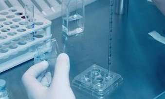 试管期间有什么是不能做的吗？