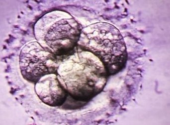 在五大连池市做试管婴儿长方案周期需要多久？超长方案促排流程是怎么样的？